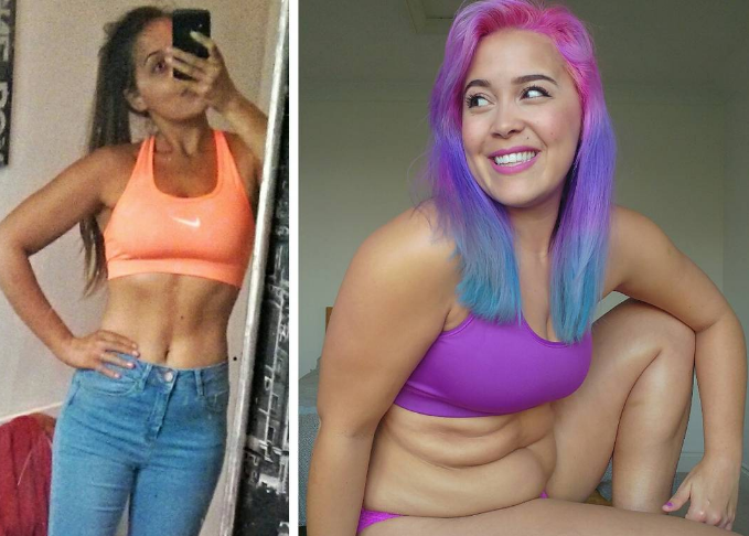 Esta chica presume de sus fotos de "antes y después" al revés 