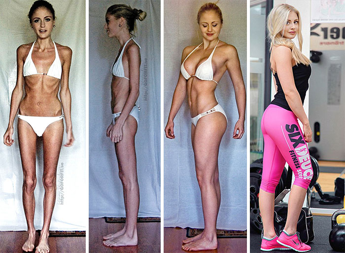 Superar la anorexia con deporte