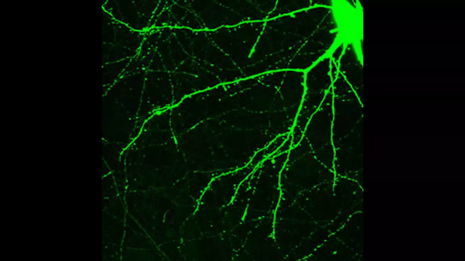 Los psicodélicos cambian rápidamente el cerebro. He aquí cómo.