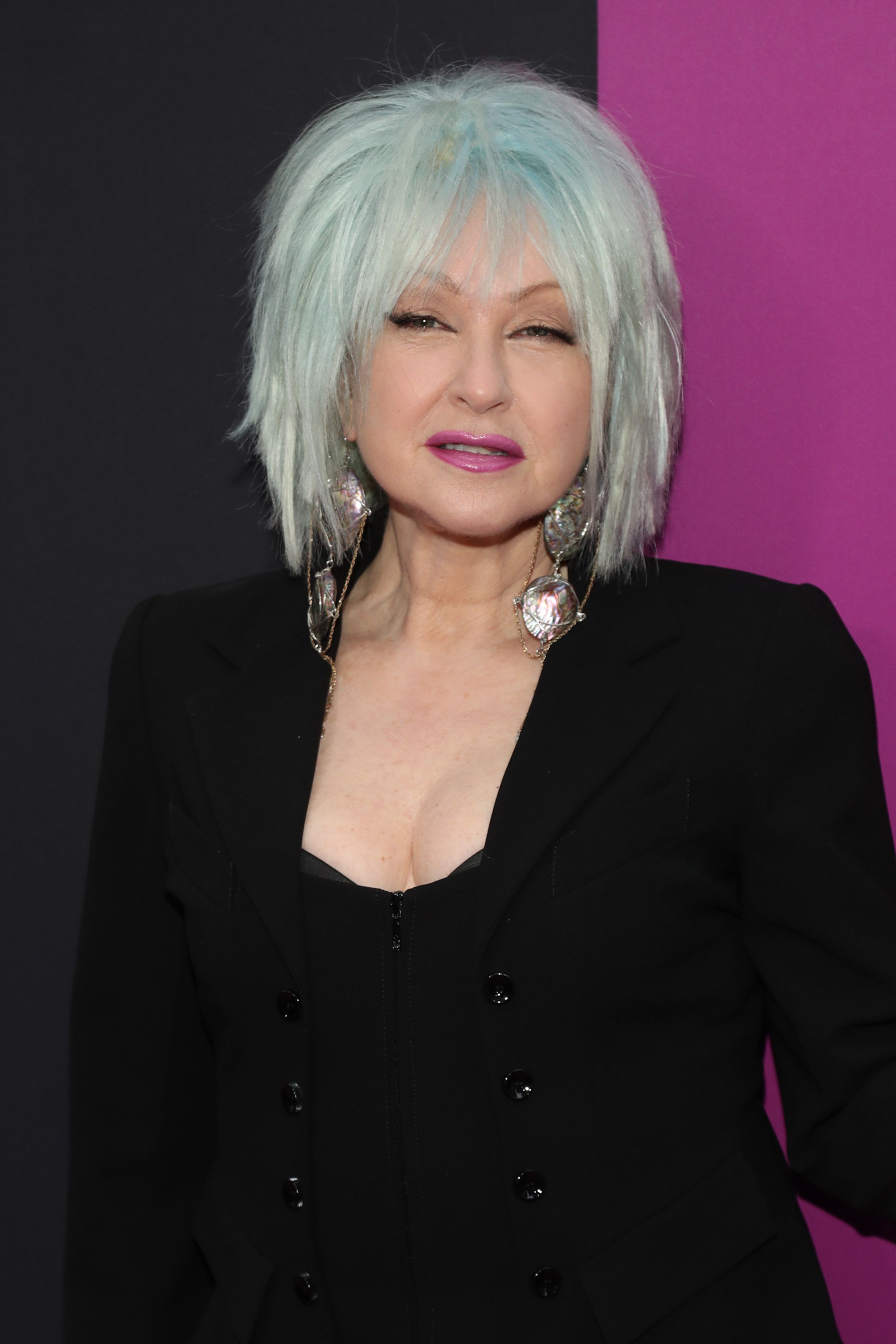 A sus 70 años, Cyndi Lauper detalla cómo se ve y se siente mejor a pesar de su enfermedad crónica