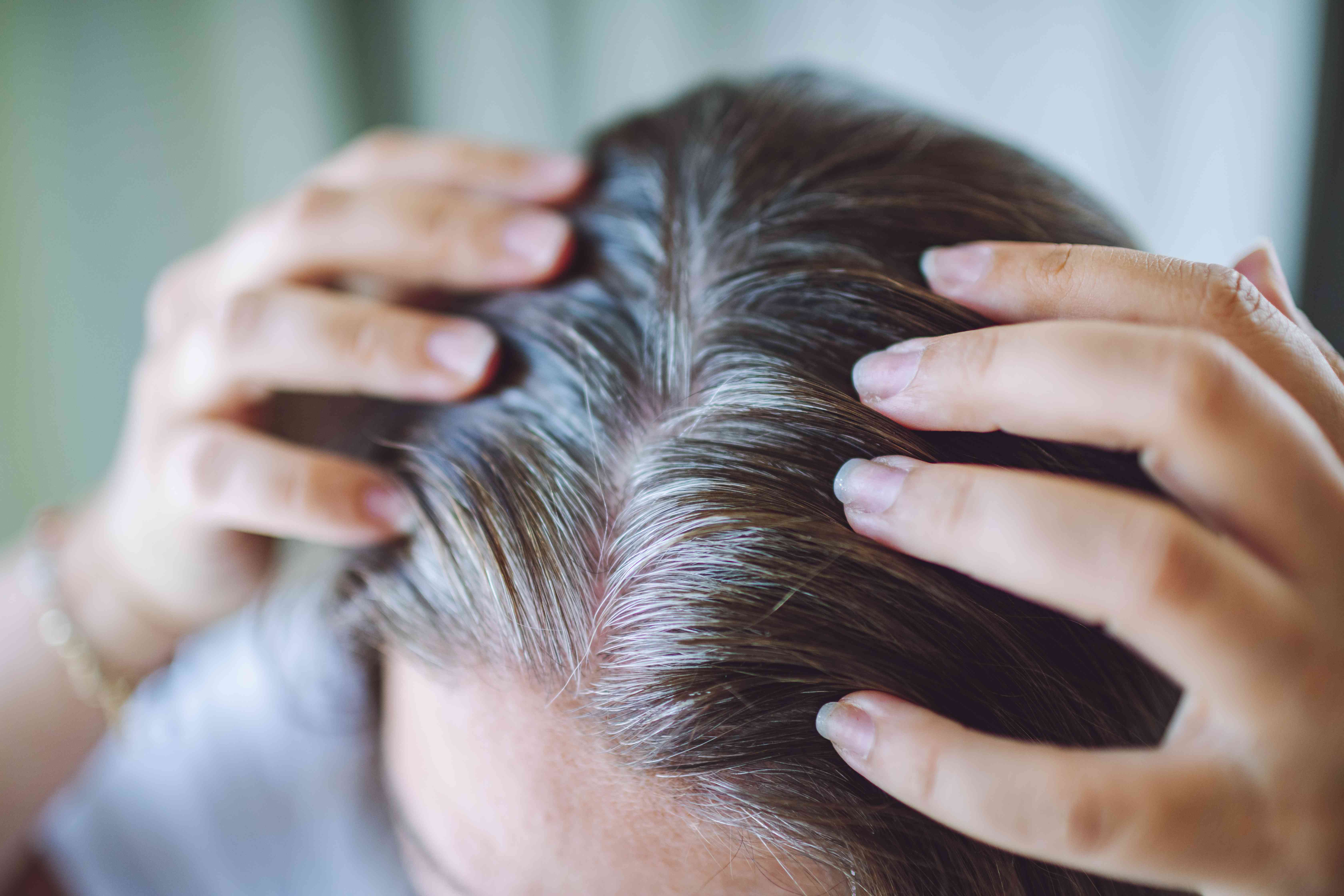 ¿Puede Comer Verduras Como Brócoli y Cebollas Realmente Detener Que Tu Cabello Se Vuelva Gris?