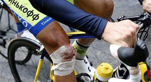 Contador no tendrá que operarse