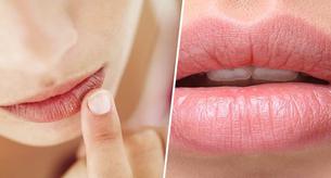 Así es tu estado de salud según el color de tus labios